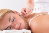 L&rsquo;acupuncture pour maigrir : comment ça fonctionne et est-ce que ca marche?